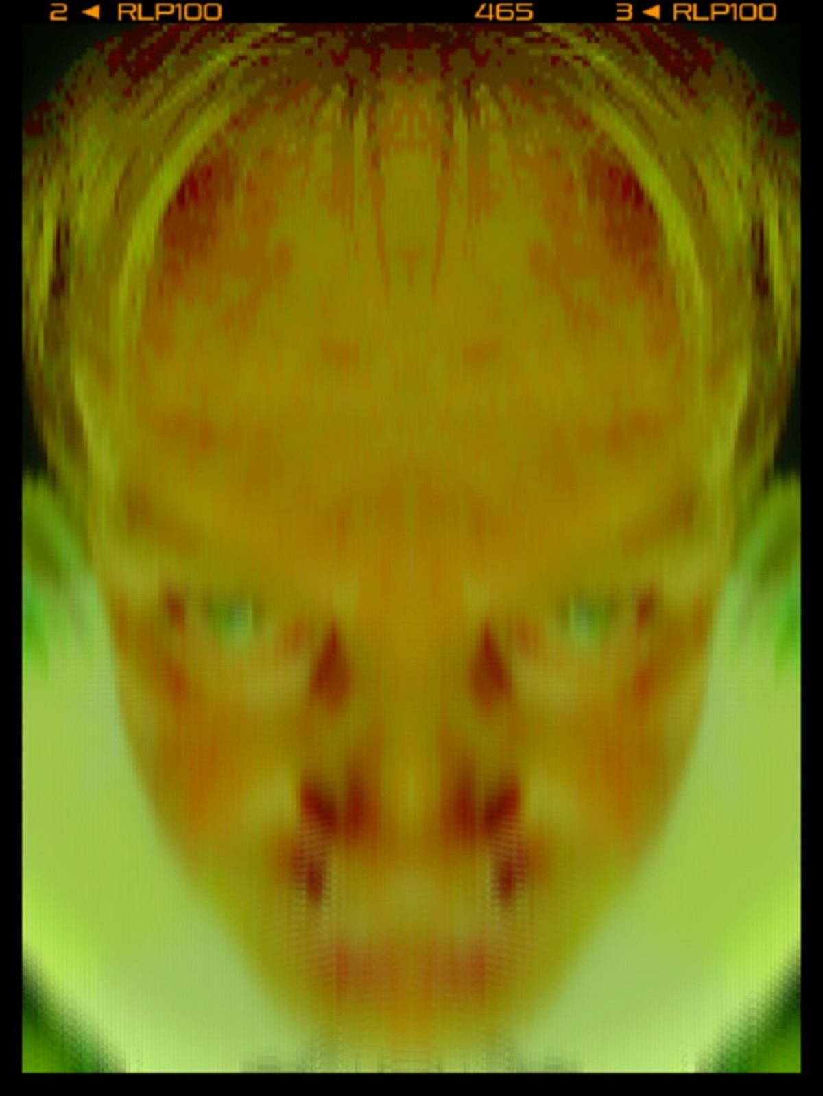 Vanoppen